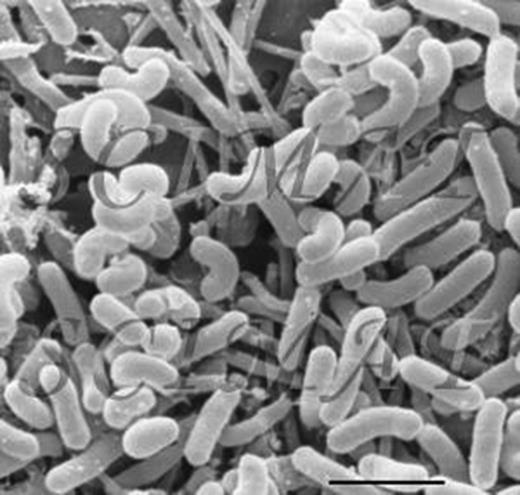 Figure 1. Lactobacillus rhamnosus.