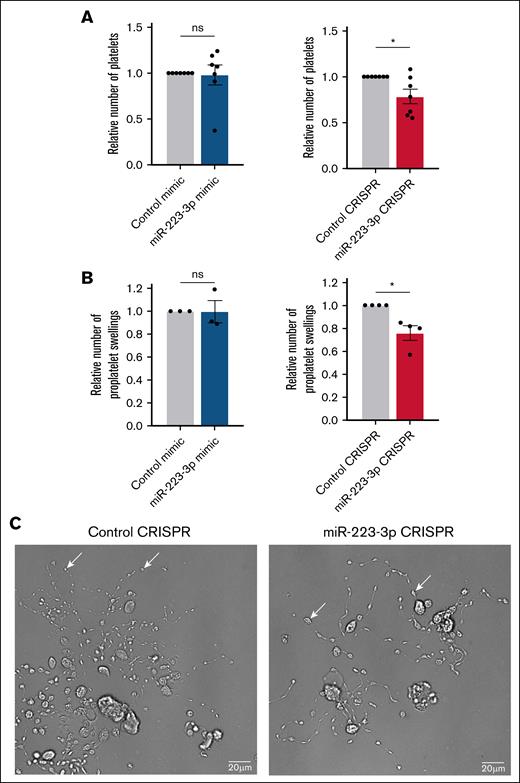 Impact of miR-223-3p modulation on thrombopoiesis. Relative number of platelets in the cell culture (A) and proplatelet swellings per MK (B), after miR-223-3p upregulation (left) or downregulation (right), compared with the negative control. (C) Representative bright-field microscopy images (ImageXpress micro confocal high-content imaging system microscope, ×20 original magnification; scale bar, 20 μm) of human MKs forming proplatelet network derived from CD34+ cells in negative control (left) and miR-223-3p downregulation (right) conditions. White arrows show proplatelet swellings. Data are from 3 to 7 independent experiments. ∗P < .05. ns, non-significant.