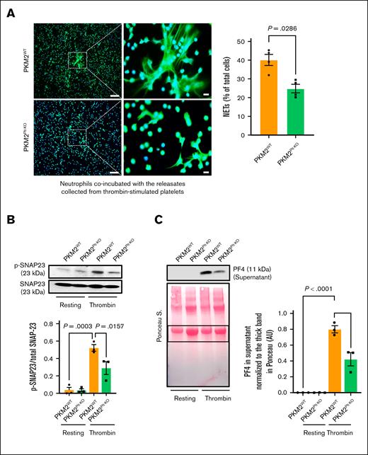 PKM2 regulates SNAP-23–mediated platelet exocytosis and consequent NETosis. (A) NETosis assay was performed by stimulating bone marrow–derived WT neutrophils with releasates collected from thrombin (0.1 U/mL)-activated platelets isolated from PKM2WT or PKM2Plt-KO mice. Representative microphotographs (left) of NET in lower magnification (20×) and higher magnification (100×) stained with Sytox green (stains extracellular DNA, green) and counterstained with Hoechst (stains nuclei, blue). Higher magnification images show NET from the boxed regions (scale bar for 20× image, 50 μm; scale bar for 100× image, 10 μm). Quantification of the percentage of cells releasing NET (right) calculated in lower magnification (20×; n = 4 per group). Values are mean ± SEM; Mann-Whitney U test. (B) Platelets isolated from WT and PKM2Plt-KO mice were stimulated with thrombin (0.1 U/mL; 2 minutes), and the level of SNAP-23 phosphorylation was measured by western blot; shown are a representative western blot (upper) and a densitometry analysis (lower) of western blots (n = 3 per group). Values are mean ± SEM; 1-way analysis of variance (ANOVA) with Tukey multiple comparisons test. (C) Platelets isolated from PKM2WT and PKM2Plt-KO mice were stimulated with thrombin (0.1 U/mL; 2 minutes) and centrifuged for 3 minutes; the level of PF4 was measured in the supernatant by western blot. The upper panel shows a representative western blot, and the lower panel shows Ponceau S staining (n = 3 per group). Values are mean ± SEM; 1-way ANOVA with Tukey multiple comparisons test.