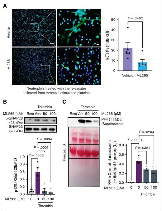 Limiting PKM2 dimerization inhibits NETosis in vitro and reduces SNAP23 phosphorylation and α-granule exocytosis in platelets. (A) NETosis assay was performed by stimulating bone marrow–derived WT neutrophils with the releasates collected from ML265 (100 μM)- or vehicle-pretreated, thrombin-stimulated (0.1 U/mL) platelets. Representative microphotographs of NET in lower magnification (20×) and higher magnification (100×) stained with Sytox green (stains extracellular DNA, green) and counterstained with Hoechst (stains nuclei, blue) are shown on the left; higher magnification images showing NET from the boxed regions (scale bar for 20× image, 50 μm; scale bar for 100× image, 10 μm). Quantification of the percentage of cells releasing NET in lower magnification is shown on the right (n =5 per group). Values are mean ± SEM; unpaired Student t test. (B) WT platelets pretreated with vehicle or ML265 (50 and 100 μM; 10 minutes) were stimulated with thrombin (0.1 U/mL; 2 minutes), and the level of SNAP-23 phosphorylation was measured by western blot. The upper panel shows a representative western blot, and the lower panel shows a densitometry analysis of western blots (n = 4 per group). Values are mean ± SEM; 1-way ANOVA with Tukey multiple comparisons test. (C) Platelets pretreated with vehicle or ML265 (50 and 100 μM; 10 minutes) were stimulated with thrombin (0.1 U/mL; 2 minutes) and centrifuged for 3 minutes; the level of PF4 was measured in the supernatant by western blot. The upper panel shows a representative western blot, and the lower panel shows Ponceau S staining (n = 4 per group). Values are mean ± SEM; 1-way ANOVA with Tukey multiple comparisons test. Rest, resting platelets; Veh, vehicle.