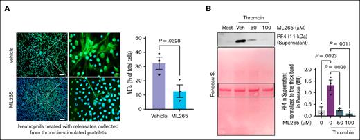 Limiting PKM2 dimerization inhibits NETosis in vitro and reduces α-granule exocytosis in platelets from human blood. (A) NETosis assay was performed by stimulating human neutrophils with releasates collected from thrombin (0.1 U/mL)-activated human platelets in the presence or absence of ML265 (100 μM); representative microphotographs (left) of NET stained with Sytox green (stains extracellular DNA; green) and counterstained with Hoechst (stains nuclei; blue) are shown in lower (20×) and higher magnification (100×); higher magnification images showing NET from the boxed regions (scale bar for 20× image, 50 μm; scale bar for 100× image, 10 μm); quantification of the percentage of cells releasing NET (n = 3 per group; right). Values are mean ± SEM; unpaired Student t test. (B) Human platelets pretreated with vehicle or ML265 (50 and 100 μM; 10 minutes) were stimulated by thrombin (0.1U/mL; 2 minutes) and centrifuged for 3 minutes; the level of PF4 was measured in the supernatant by western blot. The upper panel shows a representative western blot, and the lower panel shows Ponceau S staining (n = 3 per group). Values are mean ± SEM; 1-way ANOVA with Tukey multiple comparisons test. Rest, resting platelets; Veh, vehicle.