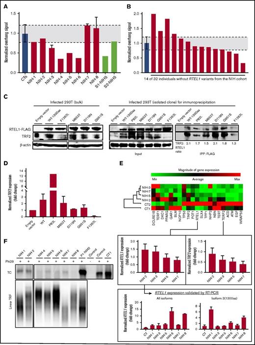 Figure 4. Impact of RTEL1 variants on telomere maintenance. (A) Normalized single-strand 3′ overhang measurement by nondenaturing Southern blot of patients from the NIH cohort and 2 siblings of NIH-5 (S1- and S2-NIH5). Relative 3′ overhang signals were determined by normalizing the sum of chemiluminescent signal (ΣODi) from each column in the nondenaturing membrane (overhang signals) by the telomeric signal in the denatured membrane (representing total genomic DNA). The background signal (sample treated with Exo1) was subtracted from total ΣODi for all the samples. Error bars represent the standard deviations of independent experiments. Patients’ 3′ overhang signals were then normalized by an average of 3′ overhang signals from healthy individuals used as a control in every experiment and plotted. The 3′ overhang signals of patients below a 95% confidence interval of 3′ overhang measurements from controls (gray interval in the graphic) were considered eroded. (B) Normalized single-strand 3′ overhang measurement of 14 patients from the NIH cohort without RTEL1 variants in which DNA was available. Three patients had telomeric overhangs below a 95% confidence interval of healthy controls that were considered short. (C) Western blot analysis. (Left) Whole extracts of bulk 293T cells stably expressing recombinant RTEL1-FLAG wild-type or one of the following RTEL1 variants: M652T, D719N, G951S, and F1262L. Control used was 293T infected with an empty vector. (Right) Whole extracts (input) of isolated RTEL1-FLAG WT or 293T clones with the P82L, M652T, D719N, G951S, and F1262L variants were immunoprecipitated with anti-FLAG to evaluate RTEL1 and TRF2 interaction. Protein expression was analyzed with antibodies as indicated. (D) TRF2 expression in both bulk-infected 293T cells and isolated clones normalized by the control (empty vector). Error bars represent the standard deviations between TRF2 expression in bulk 293T and isolated clones. (E) Clustergram of the telomere biology gene expression levels in 4 patients with RTEL1 variants from the NIH cohort and 2 controls using the RT2 Profiler PCR array system (Qiagen). Control samples were used as a reference for normalization. For comparison, the RTEL1 and TRF2 fold-change expression in relation to controls were plotted and shown in the graphic below the heatmap. The RTEL1 gene expression was validated by real-time PCR using a Taqman probe that detected the boundary of exon 7-8 in all isoforms and another probe that detected the RING domain in isoform 3. (F) Phi29-dependent t-circle amplification assay in patients’ peripheral blood. The t-circles were detected in a lower amount in patients with heterozygous variants than in biallelic patients. The asymptomatic mother of NIH-2 (P1-NIH2) and a healthy control (CT1) presented the highest number of t-circles. DNA extracted from VA13 cells was used as a control of the assay. IPP, immunoprecipitation; RT-PCR, reverse transcription polymerase chain reaction.