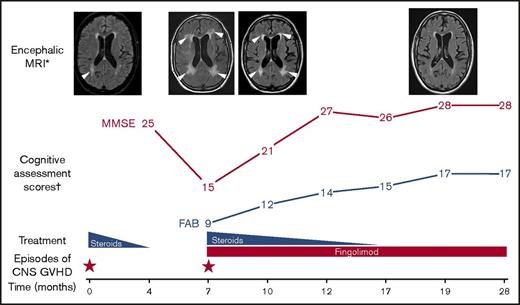 Figure 1. Clinical and morphologic response to fingolimod and steroids in a patient with CNS GVHD. *MRI images are T2-FLAIR weighted; arrowheads indicate main periventricular lesions, which gradually disappeared on treatment. †Scores were not evaluated at the time of the first episode of CNS GVHD. Any MMSE score ≥24 points (out of 30) indicates normal cognition. Any FAB score ≥16 points (out of 18 points) indicates normal executive functions. T0, time of the first episode of CNS GVHD (10 months after allo-HCT).