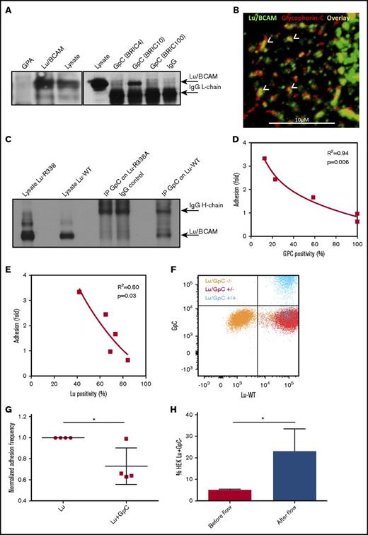 Figure 3. GpC restricts Lu/BCAM activity. (A) BRIC4, 10, and 100 were used to immunoprecipitate (IP) GpC from an erythrocyte lysate. Only BRIC10 was able to co-IP Lu/BCAM, suggesting that Lu/BCAM may mask the sialylated GpC epitope recognized by BRIC4 and possibly BRIC100 as well. Anti-CD235 was used to IP glycophorin-A (GpA). Western blotting for Lu/BCAM shows that BRIC10 co-IPs Lu/BCAM (top arrow). The anti-goat horseradish peroxidase–linked antibody directed against primary Lu/BCAM antibody was found to cross-react with the mouse light chain of the BRICS used to IP GpC (lower arrow). (B) Confocal micrograph showing Lu/BCAM clusters (fluorescein isothiocyanate, green; original magnification ×40) partially colocalizing (yellow, indicated with white arrowheads) with GpC (BRIC10, PE, red). (C) Western blot of GpC immunoprecipitation from Lu-WT and Lu-R338A transfected cells. GpC was found to co-IP only with Lu-WT. (D) GpC-ex3 (Gerbich phenotype GPC) sialylation was quantified by flow cytometry using BRIC4 and is expressed as a percentage compared with control erythrocytes (x-axis). GpC sialylation was then plotted against adhesion frequency to laminin-α5 (n = 5), which was also normalized to control (y-axis). The squared correlation coefficient (R2) is indicated. (E) Gerbich phenotype erythrocyte adhesion negatively correlates with Lu/BCAM expression. (F) Flow cytometric comparison, using BRIC4 and goat anti-human Lu/BCAM (R&D Systems), of Lu−GpC− (orange), Lu+GpC− (red), and Lu+GpC+ (blue) transfected HEK293T cells. (G) Adhesion frequency of Lu+GpC− (normalized to 1) and Lu+GpC+ HEK293T cells to laminin-α5. (H) Of the HEK293T transfected with both Lu and GpC (blue population), 5.2% failed to express GpC but did express Lu (blue population in red gate, right lower quadrant), as was assessed by flow cytometry. Upon flowing the total HEK293T cell population over laminin-coated ibidi chambers, the 5.2% GpC negative fraction was significantly enriched for on laminin-α5–coated ibidi chambers as determined by fluorescence microscopy (n = 4). *P < .05.