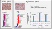 Graphical abstract for: The characteristics of vessel lining cells in normal spleens and their role in the pathobiology of myelofibrosis;