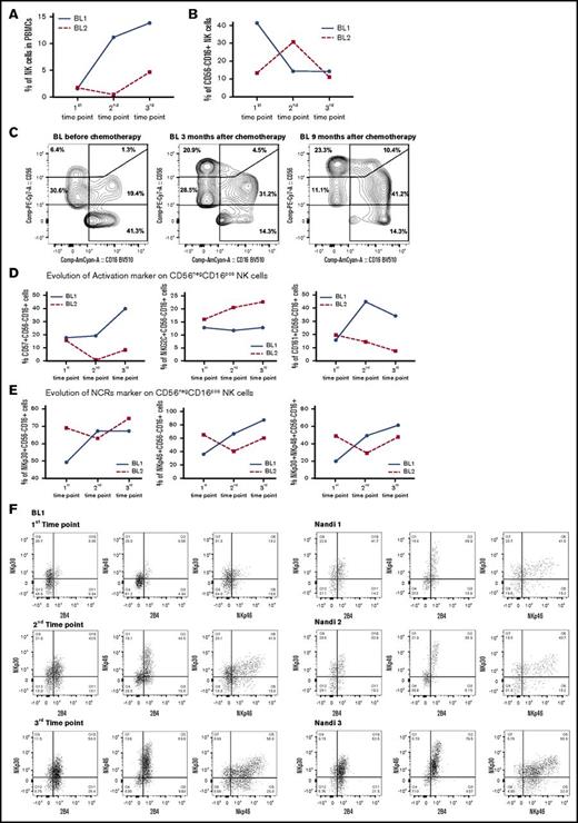 Figure 7. Resolution of the CD56neg CD16pos subset from eBL children after chemotherapy. NK cell subsets were defined by CD56 and CD16 expression. The first time point was before chemotherapy, and the second and third time points were 3 and 9 months, respectively, after diagnosis (during remission). (A) Changes in the percentage of NK cells were defined as the number of NK cells (CD56pos and/or CD16pos)/total number of live lymphocytes. (B) Changes in the percentage of CD56negCD16pos NK cells at each time point for 2 eBL patients. (C) Cytograms for the 3 time points for patient “BL1.” Changes in activation (D) and NCR (E) markers over time for both eBL children (“BL1” and “BL2”) for CD56negCD16pos NK cells. (F) Plots of NKp30/NKp46, NKp30/2B4, and NKp46/2B4 coexpression for CD56negCD16pos NK cells from an eBL1 patient during the course of treatment, as well as for 3 healthy Nandi children.