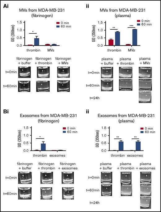 Figure 3. Thrombotic activity of exosomes and MVs from MDA-MB-231 cell line. The thrombotic activity of exosomes and MVs was tested using pure fibrin clots or clots produced in platelet-poor plasma. A total of 30 μg of exosomes or MVs was added to pure fibrinogen or platelet-poor plasma. The OD was measured at 350 nm every 2 minutes for 1 hour at 37°C. α-Thrombin was added to the fibrinogen or platelet-poor plasma as a positive control. Thrombotic activity in the presence of fibrinogen is shown for MVs (Ai) and exosomes (Bi) from MDA-MD-231 cells. The thrombotic activity with human plasma is shown for MVs (Aii) and exosomes (Bii) from MDA-MD-231 cells. Representative photographs of the experiment are presented in the lower panels. *P ≤ .05, **P ≤ .01, ***P ≤ .001, Mann-Whitney U test (1 tailed).