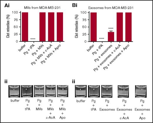 Figure 5. Fibrinolytic activity of exosomes and MVs on a plasma clot. The analysis was performed on MVs from MDA-MB-231 cells (A) and exosomes from MDA-MB-231 cells (B). Each experiment was repeated 3 times with different samples. The plasma clot was formed by incubating human platelet-poor plasma with thrombin. Then, exosomes and MVs (30 μg of protein) were added to the top of clot, followed by plasminogen (0.15 μM), with or without inhibitor (ε-AcA at 100 mM or Apro at 2.2 μM). A positive control was included, in which plasminogen (0.15 μM) and tPA (25 nM) were added directly to the freshly formed clot. The OD was measured at 350 nm every 20 minutes for 18 hours at 37°C. Results are presented as mean ± SEM (n = 3 independent samples). The percentage of clot retention is shown for MVs (Ai) and exosomes (Bi) from MDA-MD-231 cells. A representative photograph of the experiment is shown for MVs (Aii) and exosomes (Bii) from MDA-MD-231 cells. ****P ≤ .0001, Mann-Whitney U test (1 tailed).