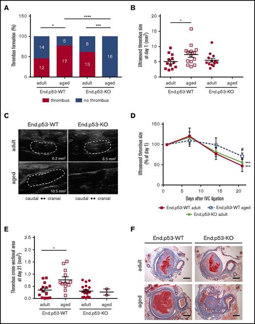 Figure 2. Thrombus formation and resolution over 3 weeks. (A) Percentage of adult and aged End.p53-WT and End.p53-KO mice, in which thrombosis after subtotal IVC ligation was observed or not. The absolute numbers per group and category (“thrombus” and “no thrombus”) are also given. Results were analyzed using χ2 test. *P < .05, ***P < .001, and ****P < .0001. (B) Thrombus size at day 1 after subtotal IVC ligation. Only mice that formed a thrombus are shown. Graphs show individual values as well as the mean ± SEM and were analyzed using 1-way ANOVA. *P < .05. (C) Representative ultrasound images of venous thrombi (encircled by broken white lines) at day 1 after subtotal IVC ligation. The calculated thrombus area is also shown. (D) Venous thrombus resolution in mice that formed a thrombus. Results are expressed as the percentage change vs thrombus size at day 1 (set at 100%) and were analyzed using 2-way ANOVA. ***P < .001 vs day 1 and #P < .05 vs adult End.p53-WT mice. (E) Serial cross sections through the thrombosed IVC segment of adult and aged End.p53-WT or End.p53-KO mice were examined 21 days after surgery and the thrombus cross-sectional area determined. Only mice that formed a thrombus are shown. *P < .05. (F) Representative Carstairs-stained cross sections of thrombosed IVC segments are shown. Scale bars represent 200 µm.
