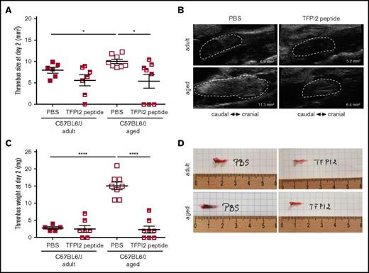Figure 7. Effect of heparanase inactivation on venous thrombus formation in mice. (A) Venous thrombosis was induced by subtotal IVC ligation in C57BL/6J mice at the age of 12 weeks (adult) or 12 months (aged). Mice were injected with TFPI2 peptide (2 mg/g body weight) 30 minutes before and every 24 hours after surgery. (A) High-frequency ultrasound determination of thrombus size at day 2 after surgery. Individual values and the mean ± SEM per group are shown. *P < .05. (B) Representative ultrasound images. The thrombus circumference is highlighted by broken white lines. The calculated thrombus area is also shown. (C) Thrombus weights at tissue harvest on day 2. Individual values and the mean ± SEM per group are shown. ****P < .0001. (D) Representative macroscopic images of thrombosed vein segments immediately after removal.
