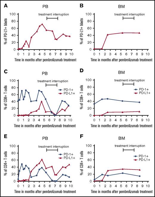 Figure 2. Expression of PD-L1 and PD-1 on AML blasts and T cells prior to and during PEM therapy. PB- and BM-derived AML blasts (A-B) and T cells (C-F) were stained with fluorochrome-conjugated antibodies and analyzed by flow cytometry prior to and at various time points during PEM treatment. Blasts were defined as CD45low cells and stained for PD-L1 expression. Furthermore, T cells were characterized as CD45+, CD3+, and CD4+ or CD8+ populations. CD8+ T cells (C-D) and CD4+ T cells (E-F) were analyzed for their expression of PD-1 and PD-L1. Values in the graphs represent the percentage of cells staining positive for each molecule at indicated different time points.