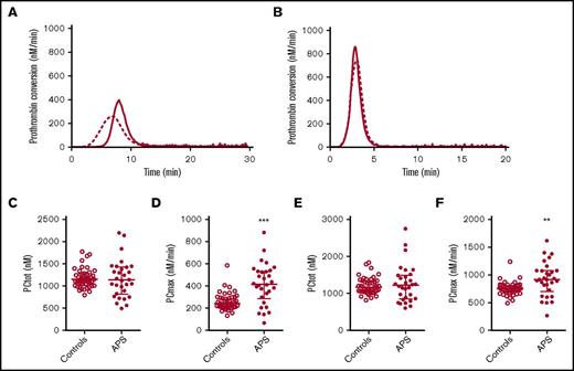 Figure 2. Prothrombin conversion in APS patients and controls. Average prothrombin conversion curves are shown for healthy controls (dashed line) and APS patients (continuous line) at 1 (A) and 5 (B) pM TF. Prothrombin conversion parameters for the total amount of prothrombin converted (PCtot; C,E) and maximum rate of prothrombin conversion (PCmax; D,F) were quantified for 1 and 5 pM TG curves, respectively. ***P < .001, **P < .01 according to a 2-sided Mann-Whitney U test.