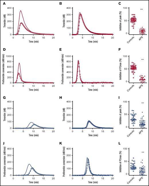 Figure 4. Thrombomodulin sensitivity of TG and thrombin dynamics in healthy subjects and APS patients with (blue) or without VKA treatment (red). (A-C) The inhibition of TG (continuous line) by 20 nM TM (line with circle symbols) was measured in healthy controls (A) and APS patients without VKAs (B). The effect of TM was quantified as the percentage inhibition of TG peak height (C). (D-F) The inhibition of prothrombin conversion (continuous line) by 20 nM TM (line with circle symbols) was measured in healthy controls (D) and APS patients without VKAs (E). The effect of TM was quantified as the percentage inhibition of PCmax (F). (G-I) The inhibition of TG (continuous line) by 20 nM TM (line with circle symbols) was measured in controls on VKA (G) and APS patients on VKAs (H). The effect of TM was quantified as the percentage inhibition of TG peak height (I). (J-L) The inhibition of prothrombin conversion (continuous line) by 20 nM TM (line with circle symbols) was measured in controls on VKA (J) and APS patients on VKAs (K). The effect of TM was quantified as the percentage inhibition of PCmax (L). ***P < .001 compared with the control group using a 2-sided Mann-Whitney U test.