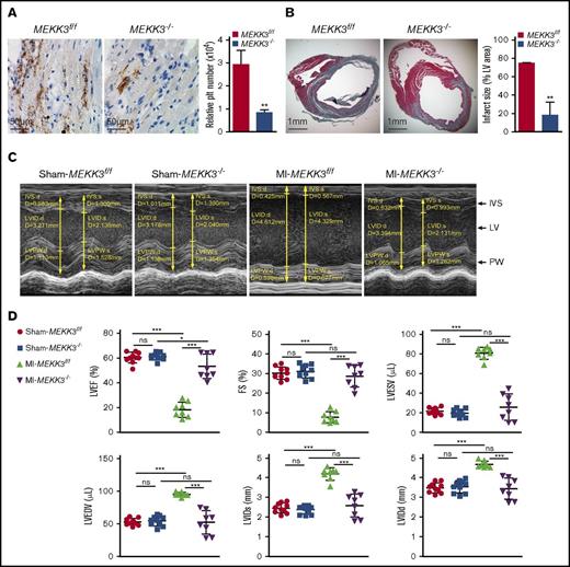 Figure 5. Platelet MEKK3 deficiency reduced microvascular obstruction and infarct expansion post-MI. (A) CD42C staining of hearts from MEKK3f/f and MEKK3−/− mice on day 3 following ligation of the LAD artery (original magnification ×400). Relative platelet (plt) number (pixels) in 4 random fields per experiment was quantified (mean ± SD). (B) Masson’s trichrome staining in parasternal short-axis sections of hearts from MEKK3f/f and MEKK3−/− mice on day 7 post-LAD coronary artery ligation (original magnification ×20). Masson’s trichrome–stained areas were measured. Infarct size is expressed as a percentage of the LV area (n = 3, mean ± SD). (C) Representative M-mode echocardiograms for MEKK3f/f and MEKK3−/− mice on day 7 post–LAD coronary artery ligation. (D) Echocardiography quantification of LVEF, LVFS, LVESV, LVEDV, LVIDs, and LVIDd in MEKK3f/f and MEKK3−/− mice on day 7 post–LAD coronary artery ligation (n = 8-10, mean ± SD). *P < .05, **P < .01, ***P < .001. IVS, interventricular septum; PW, posterior wall.