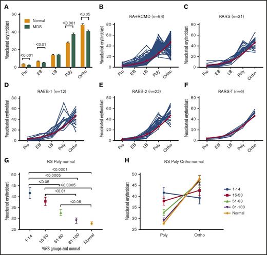 Figure 2. TED is abnormal in patient samples. (A) Bar diagram showing percentage of nucleated erythroid cells in each stage of TED. When compared with normal (n = 16), MDS/MDS-MPN/secondary acute myeloid leukemia samples (n = 95) were characterized by a significant decrease in percentage of cells in pro and EB stages and a significantly abnormal increase of cells in the poly stage, and a decrease in the ortho stage. Data in bar diagram are presented as mean ± standard error of the mean. Each TED stage was compared between normal and MDS samples using unpaired, 2-tailed, nonparametric t test (Mann-Whitney U). (B-F) Line plot showing percentage of cells quantified in each TED stage in individual samples of WHO subgroups. (B) RA and RCMD, (C) RARS, (D) RAEB-1, (E) RAEB-2, and (F) RARS-T. Red line is the mean percentage of cells observed in normal individuals. (G-H) RS subgroups and TED. (G) Pot showing percentage of nucleated erythroblast cells in the poly stage within various RS subgroups and normal samples. There was significant difference in the poly stage between different RS subgroups; less cell arrest was observed in the poly stage as RS increased. All data are presented as mean ± standard error of the mean. Samples were compared using 1-way analysis of variance (Kruskal-Wallis test); multiple comparisons were done using the uncorrected Dunn test. (H) A graph showing inverse relation between poly and ortho stages within various RS groups and normal. Less arrest in poly is translated into more ortho stages. RA, refractory anemia; RS, ring sideroblast.