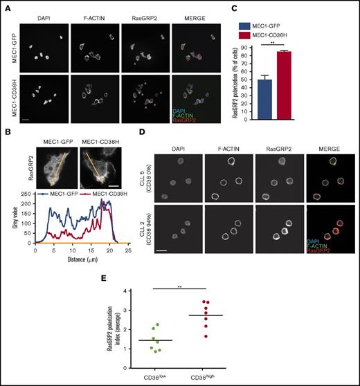 Figure 6. CD38 increases polarized RasGRP2 localization. Cells were stained with anti-RasGRP2 antibody followed by Alexa Fluor 546–conjugated anti-rabbit antibody and imaged by confocal microscopy. F-actin and nuclei were stained with Alexa Fluor 488–conjugated phalloidin and DAPI, respectively. (A) Representative images of RasGRP2 localization in MEC1-GFP and MEC1-CD38H cells. Examples of cells with polarized RasGRP2 localization are indicated with an asterisk. Scale bar, 20 µm. (B) Fluorescence intensity profile of RasGRP2 obtained along the longitudinal axis of 2 representative MEC1-GFP and MEC1-CD38H cells. Scale bar, 5 µm. (C) The percentage of cells with polarized RasGRP2 localization was quantified by scoring n ≥ 100 cells in each of the 3 independent experiments. **P < .01, determined by 2-tailed Student t test. (D-F) RasGRP2 localization in CD38high and CD38low CLL patient samples. (D) Representative images of one CD38high (CLL 2) and one CD38low (CLL 5) CLL sample are shown. Scale bar, 10 μm. (E) The RasGRP2 polarization index, indicating distribution of the fluorescence intensity, was calculated using ImageJ Oval Profile plug-in (supplemental Data). Graph shows the mean values obtained for each CLL patient sample (n ≥ 30 cells analyzed per sample), horizontal bars indicate mean values of the RasGRP2 polarization index obtained for the 2 groups by grouping CD38low (n = 7, green) and CD38high (n = 7 red) samples. **P < .01, determined by 2-tailed Student t test.