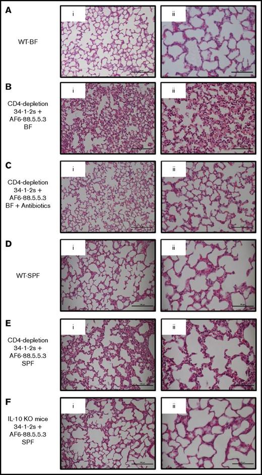 Figure 3. SPF and BF mice with antibiotic-induced gut flora depletion do not display signs of severe antibody-mediated acute lung injury on lung tissue histology. Lung histology from indicated mouse groups. Panels Ai-Fi and Aii-Fii represent lung tissue images taken at original magnification ×20 and ×40, respectively (hematoxylin and eosin stain). Representative images of each indicated group are shown. Scale bars represent 100 µM (Ai-Fi) and 50 µM (Aii-Fii). WT, wild type.