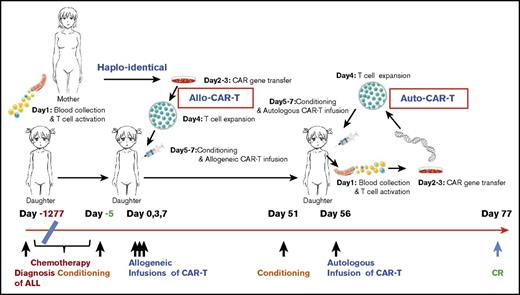 Figure 1. The time line and key events of the allogeneic/autologous CAR-T treatment regimen. The patient was diagnosed with ALL on day −1277 (−42.5 months) and received extensive chemotherapy but developed refractory relapses with lung infections. Maternal source CD19 CAR-T cells were prepared based on a 5- to 7-day CAR-T–cell preparation protocol as illustrated on the top. Allo–CAR-T cells were infused on days 0, 3, and 7, after conditioning chemotherapy. The patient achieved a partial response (PR) in 50 days and received an auto–CAR-T infusion on day 56 after conditioning chemotherapy. CR was achieved on day 77.