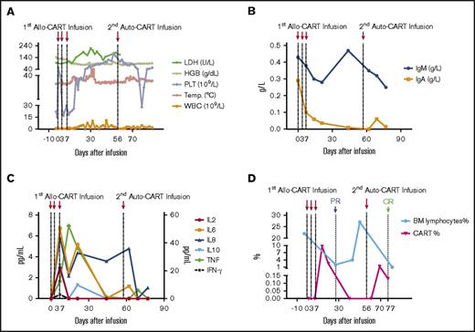 Figure 2. Biochemical and immunological kinetics after allo–/auto–CAR-T-cell infusions. (A) Kinetics of hematologic correlates and body temperature. After allo–CAR-T-cell infusions, the body temperature (Temp.) and white blood cell (WBC) count fluctuated continuously, and the platelet count increased gradually. The hemoglobin (HGB) remained steady, and lactate dehydrogenase (LDH) went up correlated with inflammatory response and tumor reduction. (B) The kinetics of IgA and IgM. (C) The kinetics of inflammatory cytokines. The plasma levels of various cytokines were determined by CBA bead array. (D) The kinetics of BM lymphocytes (BM%) and CAR-T cells (CART%). After allo–CAR-T and auto–CAR-T infusions, BM lymphocytes rapidly dropped as did leukemic cell burden, which elicited PR and CR, respectively. The reduction of leukemic cells correlated with CAR-T–cell expansion.