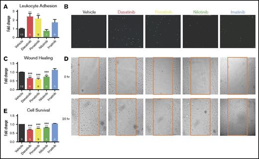 Figure 1. HUVECs as a model for TKI-associated vascular toxicity. HUVECs were treated with clinically relevant concentrations of nontoxic imatinib and compared directly to 3 toxic TKIs (dasatinib, ponatinib, and nilotinib). (A-B) Leukocyte adhesion (A) was quantified from representative images (B) of adherent fluorescently labeled U937 leukocytes. (C-D) Wound healing (C) was determined by quantifying the number of HUVECs that migrated into the scratch wound from representative images (D) after 20 hours. (E) HUVEC survival was quantified by the Cell TiterGlo Luminescent assay. Data are presented as mean fold change ± standard error of the mean relative to vehicle-treated control. Significance was determined by 1-way analysis of variance and Dunnett post-test. **P < .01; ***P < .001 vs vehicle. ###P < .001 vs imatinib. The number of experiments per condition is displayed within each bar. (B,D) Original magnification ×4.
