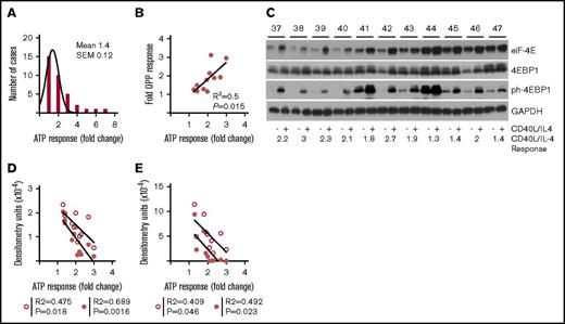 Figure 1. Increased global translation is a characteristic of CD40L/IL-4 stimulation. (A) CLL cells were cultured either on tissue culture plastic (PL), untransfected mouse fibroblasts (NTL) or mouse fibroblasts expressing CD40L and with IL-4 in the medium (CD40L/IL-4). Histogram showing fold-increases in ATP luminescence comparing CD40L/IL-4 with NTL. The mean increase is 1.4-fold (SEM = 0.12) (n = 37). (B) Association between fold increase in ATP luminescence (comparing CD40L/IL-4 and PL conditions) and incorporation of OPP (a measure of new protein synthesis; n = 11) (R2 = 0.5, P = .015). (C) Western blots showing the effects of CD40L/IL-4 culture on expression of eIF4E, 4EBP1, and ph-4EBP1 (n = 11). Glyceraldehyde-3-phosphate dehydrogenase (GAPDH) is the loading control. Patient identification (ID) is given above (labeled 37-47) and fold response to CD40L/IL-4 stimulation below the autorads. (D) Correlation of eIF-4E levels without stimulation (solid circles) or following CD40L/IL-4 stimulation (open circles) with ATP response (without stimulation R2 = 0.689, P = .0016 and following stimulation R2 = 0.475, P = .018). (E) Correlation of phosphorylated-4EBP1 levels without stimulation (solid circles) or following CD40L/IL-4 stimulation (open circles) with ATP response (without stimulation R2 = 0.492, P = .023 and following stimulation R2 = 0.409, P = .046).