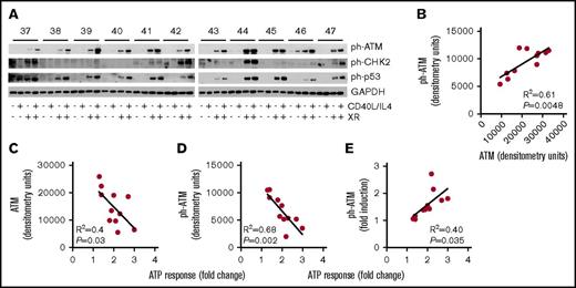Figure 6. Activation of ATM associates with CD40L/IL-4 responses. (A) Western blots showing the effects of CD40L/IL-4 culture and XR (5 Gy) on levels of ph-ATM, ph-p53, and ph-CHK2. GAPDH is the loading control. Patient ID is given above (labeled 37 to 47) the autorads. Those samples that received XR are indicated. (B) Correlation between levels of total and ph-ATM after CD40L/IL-4 stimulation and ATP response (R2 = 0.61, P = .0048). (C) Levels of total ATM after CD40L/IL-4 stimulation correlated with fold-increase in viability due to CD40L/IL-4 (R2 = 0.4, P = .03). (D) Levels of ph-ATM after CD40L/IL-4 stimulation correlated with fold-increase in viability due to CD40L/IL-4 (R2 = 0.68, P = .002). (E) Fold increase in ph-ATM after CD40L/IL-4 stimulation correlated with fold-increase in viability due to CD40L/IL-4 (R2 = 0.4, P = .035).