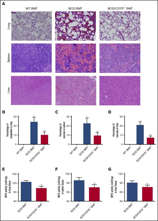 Figure 2. Genetic deletion of CD73 in SCD mice decreases multiorgan damage including lung, spleen, and liver. (A) H&E staining of lungs, spleens, and livers of WT BMT, SCD BMT, and SCD/CD73−/− BMT mice (magnification ×200). (B-D) Semiquantitative analysis of H&E-stained sections show decreased lung congestion, spleen necrosis, and liver necrosis in SCD/CD73−/− BMT mice compared with SCD BMT mice. (E-G) MPO activity in multiple organs including lung, spleen, and liver in SCD/CD73−/− BMT mice compared with SCD BMT mice. Data are expressed as mean ± SEM. n = 5 for each group; *P < .05 vs WT, **P < .05 vs SCD, Student t test.