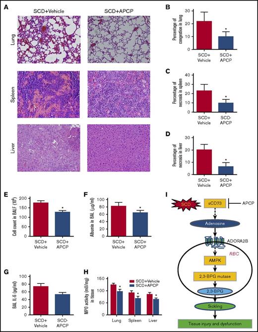 Figure 6. APCP treatment in SCD mice decreases multiorgan damage, including lung, spleen, and liver. (A) H&E staining of lungs, spleens, and livers of SCD mice with or without APCP treatment (magnification ×200). (B-D) Semiquantitative analysis of H&E-stained sections showed decreased lung congestion, spleen necrosis, and liver necrosis in SCD mice following APCP treatment. (E) BALF total cell count, (F) BALF albumin concentration, and (G) BALF IL-6 concentration in SCD mice with or without APCP treatment. (H) MPO activity in multiple organs, including lung, spleen, and liver in SCD mice with or without APCP treatment. Data are expressed as mean ± SEM. *P < .05 vs SCD, Student t test. (I) Working model: CD73 is essential for induction of plasma adenosine in SCD. Elevated plasma adenosine contributes to erythrocyte sickling, tissue injury, and dysfunction by engagement of ADORA2B on erythrocytes to induce 2,3-BPG mutase activity and 2,3-BPG production. AMPK is a key enzyme that functions downstream of ADORA2B to activate 2,3-BPG mutase and promote 2,3-BPG production and subsequent erythrocyte sickling. Preclinically, inhibition of CD73 is a promising therapeutic strategy to treat SCD or prevent hypoxia-induced tissue damage. APCP treatment decreases multiorgan damage, including lung, spleen, and liver in SCD mice.