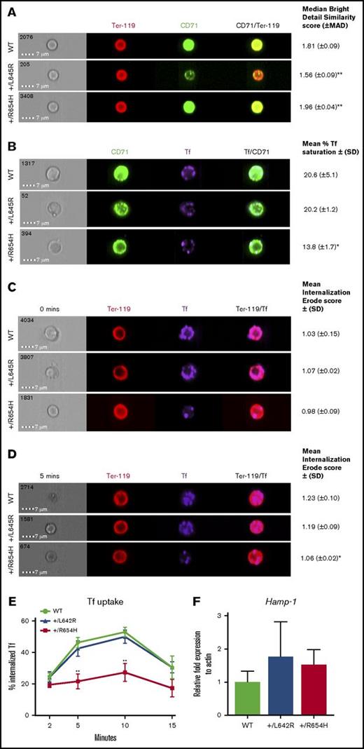 Figure 3. Analysis of TfR binding and internalization using Amnis flow imaging cytometry. (A) CD71/Ter-119 colocalization imaging of erythroblasts obtained from the bone marrow of WT, RBC6 (Tfrc+/L645R), and RBC21 (Tfrc+/R654H) mice. Intensity of CD71/Ter-119 overlap (yellow) generates the median bright detail similarity score. (B) Tf/CD71 colocalization imaging of erythroblasts from the 3 cohorts. Intensity of Tf/CD71 overlap (pale blue) generates the median bright detail similarity score, which is normalized to generate the mean percentage of Tf saturation. (C) Tf/Ter-119 internalization imaging of erythroblasts from each cohort at 0 minutes (before initiation of endocytosis). The mean internalization erode score of Tf uses Ter-119 as the mask. (D) Tf/Ter-119 internalization imaging of erythroblasts from each cohort at 5 minutes postinitiation of endocytosis. All scores represent 2000 Ter-119+ events captured in each cohort. (E) Total time course of Tf uptake, via endocytosis, calculated in Ter-119+ erythroblasts from each cohort. Mean ± (SD) shown in error bars. (F) Quantitative real-time polymerase chain reaction of liver Hamp-1 messenger RNA expression in each cohort. Mean ± (SD) shown (n = 6). *P < .05, **P < .01. MAD, median average deviation.