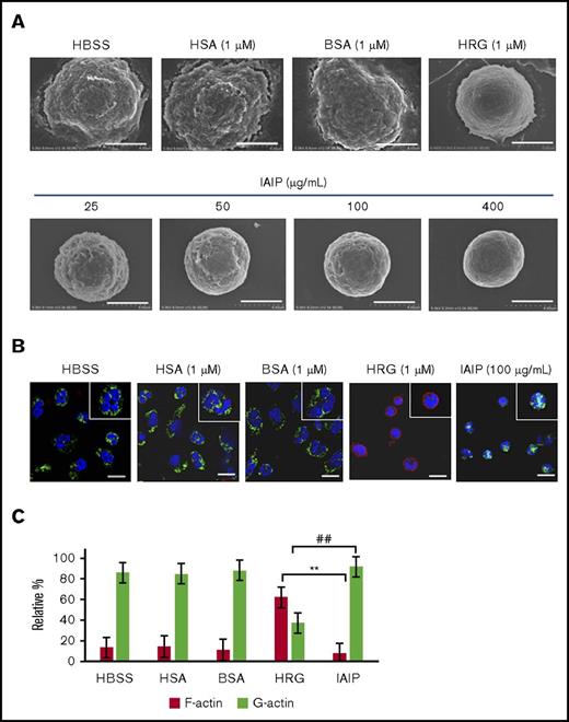 Figure 2. Effects of IAIPs on surface structure and cytoskeletal arrangement in neutrophils. The purified human neutrophils were incubated with HBSS, HSA (1 μM), BSA (1 μM), HRG (1 μM), or different concentrations of IAIPs (25-400 μg/mL) in a 96-well microtiter plate for 1 hour at 37°C. (A) After fixation as described in “Methods,” scanning electron microscopic pictures of neutrophils were obtained. Typical cell appearance is shown from each group. All images were acquired at 12 000× magnification. Scale bars, 4.0 μm. (B) After 1-hour incubation at 37°C, the neutrophils were fixed with 4% PFA, and monomer actin (green) and F-actin (red) were stained immunohistochemically. All images acquired at 40× original magnification by confocal laser microscope. Typical cells are shown from each group. Insets represent the higher magnification picture of a single cell from each group. Scale bars, 10 μm. (C) The numbers of F-actin and G-actin dominant cells in panel B were counted in each group and were expressed as relative percentage. The results shown are the means ± SEM of 3 experiments. **P < .001, HRG F-actin vs IAIP F-actin; ##P < .001, HRG G-actin vs IAIP G-actin.