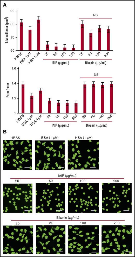 Figure 4. Comparison of the effects of IAIPs and bikunin on neutrophil shapes. The neutrophils were incubated with HBSS, HSA (1 μM), BSA (1 μM), IAIPs (25-200 μg/mL), or bikunin (25-200 μg/mL) for 1 hour and the neutrophil shapes were observed under a fluorescence microscope. (A) The rounding and size of neutrophils were analyzed by the In Cell Analyzer 2000. Cell area and form factor were determined on 5 × 104 cells on each group. Bikunin did not induce spherical shape even at high concentrations in neutrophils. The results shown are the means ± SEM of 7 experiments. (B) Typical picture from each group is shown (calcein stain; scale bars, 20 μm). NS, not significant compared with HBSS group.
