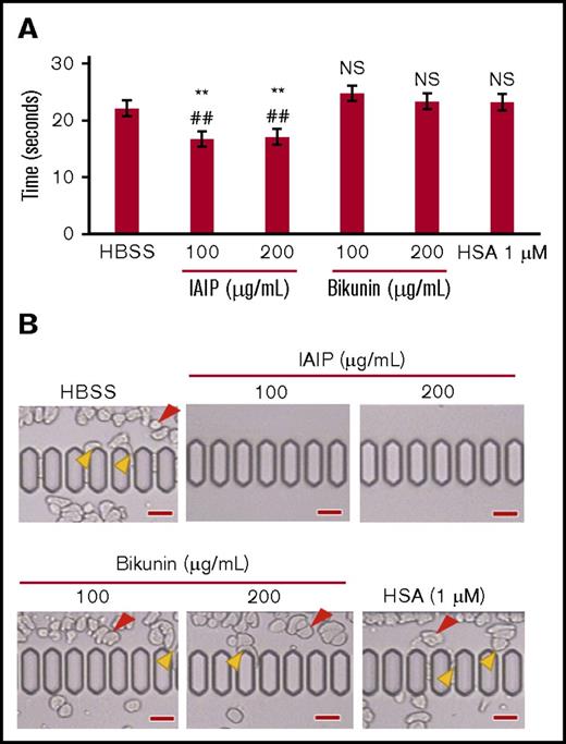 Figure 5. Neutrophil passage through microcapillaries. The purified human neutrophils were incubated with HBSS, HSA (1 μM), IAIPs (100 and 200 μg/mL), or bikunin (100 and 200 μg/mL) for 30 minutes and then applied to an MC-FAN. (A) The time required for the passage of 100-μL neutrophil suspension through the MC-FAN was determined (supplemental Video 1). The results shown are the means ± SEM of 5 experiments. **P < .01 vs HBSS; ##P < .01 vs HSA. (B) Red arrowheads indicate the leukocytes attached to the upper chamber. Yellow arrowheads indicate the leukocytes attached to the microcapillary entrance or slit (scale bars, 30 μm). NS, not significant compared with both HBSS and HSA groups.