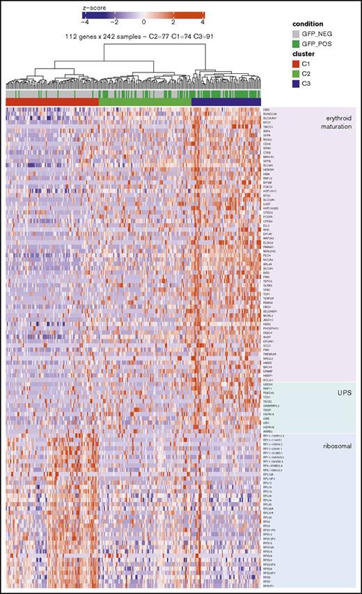 Figure 3. Heatmap showing a subset of genes differentially expressed between day-29 GFP−and GFP+ sorted fractions. Heatmap illustrating downregulation of ribosomal transcripts, upregulation of a subset of genes involved in the ubiquitin-proteasome system (UPS) pathway and increased expression of genes linked to erythroid maturation in GFP+ vs GFP− cells. In addition to genes coding for ribosomal proteins, this heatmap contains a selection of genes identified in supplemental Figure 4 as linked to erythroid maturation based on comparison of transcriptomic data sets representing terminal erythroid maturation found in the literature.40,44 The UPS-related genes shown represent a subset of these erythroid maturation genes identified in supplemental Figure 4.