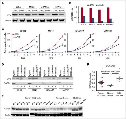 MYC knock-down inhibits cell growth: MYC, a bona fide client of HSP90 chaperon, is overexpressed in MCL patient samples. (A) Immunoblot showing reduction in MYC expression 4 days after transfection with siMYC or control (CTRL, pmaxGFP Vector provided by Amaxa) in MCL cell lines. GAPDH, loading control. (B) MYC protein levels determined by immunoblotting in panel A were quantified and normalized to GAPDH. (C) Growth of siMYC or GFP-transfected MCL cells over the course of 8 days postnucleofection. (D) Immunoblot of MYC in MCL whole-cell lysates (lane1s), chemical precipitates with PU-H71-conjugated beads (lane 2s), immunoprecipitates with anti-HSP90-conjugated beads (lane 3s) or control beads (lane 4s). GAPDH, loading control. (E) Immunoblot of HSP90 in primary MCL cells (Pt 1-11, n = 11), in normal B cells from 5 healthy donors (N1-N5), or from MCL cell lines. b-actin, loading control. (F) Levels of HSP90 protein in each groups shown in panel B were quantified and normalized to b-actin. One-way analysis of variance was used for statistical analysis. Bars represent means ± standard error of the mean. P values are indicated.