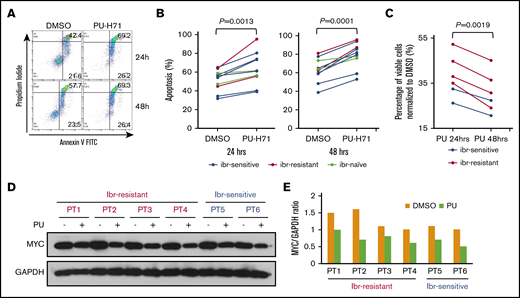 PU-H71 induces apoptosis in primary MCL cells. (A) Apoptosis measured by PI/annexin V double staining after 0.5 μM PU-H71 treatment in a representative tumor sample. (B) Line graphs showing increased apoptosis in 10 MCL tumor samples after 24 to 48 hours of PU-H71 treatment at 0.5 μM. (C) Line graph showing decreased cell viability in 6 additional MCL tumor samples after 24 and 48 hours of PU-H71 treatment. Student t test was used for statistical analysis for panels B-C. (D) Immunoblot showing reduced MYC expression after PU-H71 treatment for 24 hours in the 6 samples from panel C. (E) MYC protein levels determined by immunoblotting in panel D were quantified and normalized to GAPDH.
