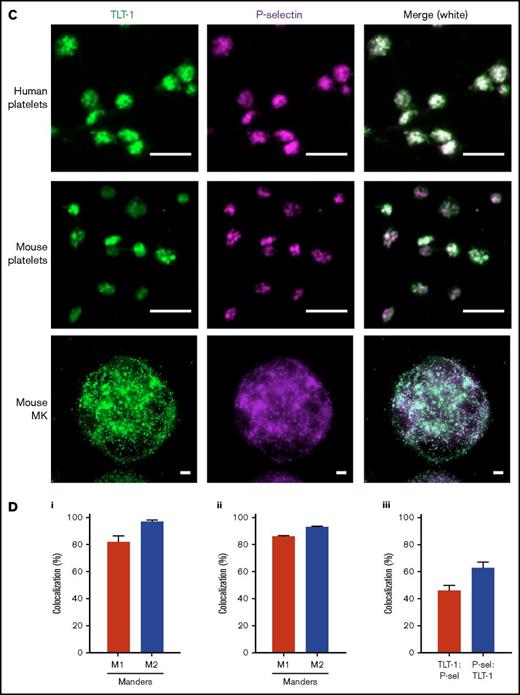 TLT-1 appears more rapidly and is detected throughout laser-induced thrombi in vivo. Mice were injected with anti-GPIbβ, anti-TLT-1, or anti-CD62P antibody. Arterioles of cremaster muscles were subsequently injured by laser. (A) Representative composite bright-field and fluorescence images of platelets (GPIbβ), TLT-1, and P-selectin in thrombi. Scale bars, 10 µm. (B) Quantification of fluorescence area in pixels (data represent mean ± standard error of the mean; n = 25-32 injuries from 4 to 6 mice). (C) Distinct and overlapping staining of TLT-1 and P-selectin in platelets and megakaryocytes. Resting human (top row) and mouse (middle row) platelets seeded on poly-l-lysine and primary mouse BM-derived megakaryocytes (MK) (bottom row) spread on fibrinogen matrix for 15 minutes at 37°C were fixed, permeabilized, and stained with Alexa Fluor 488 anti-TLT-1 and Alexa Fluor 647 anti-P-selectin antibodies. The right column represented an overlay of both images. Scale bars, 5 µm. Images are representative of 3 to 4 independent experiments. (D) Degree of TLT-1 and P-selectin colocalization as determined by the Manders overlap coefficients (M1: TLT-1:P-selectin and M2: P-selectin:TLT-1) in resting human (i) and mouse platelets (ii), and object-based colocalization in mouse BM-derived megakaryocytes (iii) (n = 3-4 independent experiments per condition, 400-600 platelets, and 25-35 megakaryocytes per experiment).
