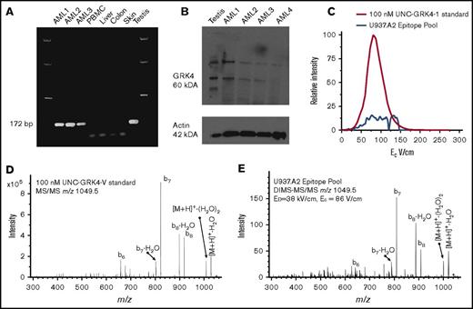 Figure 5. UNC-GRK4-V is expressed in AML. (A) GRK4 has limited tissue expression, with transcripts only detectable by RT-PCR in human AML and testis, but not in PBMCs, liver, colon, or skin. (B) Western blot confirms GRK4 protein expression in testis and 3 of 4 human AML samples. (C) Extracted ion chromograms using DIMS identifies the EC to allow the maximum signal from UNC-GRK4-V (m/z = 1049.5) into the MS using the pure standard (red trace), which was 86 V/cm. Extracted ion chromogram of m/z = 1049.5 in the U937.A2 cell epitope pool (blue trace) shows that other species with m/z = 1049.5 can be detected across a range of EC. (D) The fragmentation pattern for pure UNC-GRK4-V peptide was determined for comparison with results from the peptide pool. (E) Targeted MS was performed on the epitope pool by setting EC = 86 V/cm and fragmenting the parent ion with an m/z = 1049.5. The resulting MS/MS spectrum is virtually identical to that of the pure peptide.