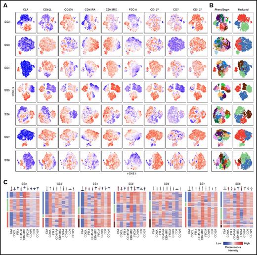 Figure 3. Coexpression of surface markers divide malignant cells into subpopulations. (A-B) Coexpression of a panel of surface markers within the malignant population of 7 patients with SS visualized by t-SNE plots colored by (A) fluorescence intensity of the indicated markers or (B) automated clustering using the PhenoGraph algorithm showing all (left) or a reduced number of clusters (right). (C) Single-cell heat maps distributed by reduced PhenoGraph cluster (left bar) and colored by fluorescence intensity of the indicated markers. Violin plots (top) display the overall expression range of the indicated markers within the total malignant population. CLA, cutaneous lymphocyte-associated antigen.