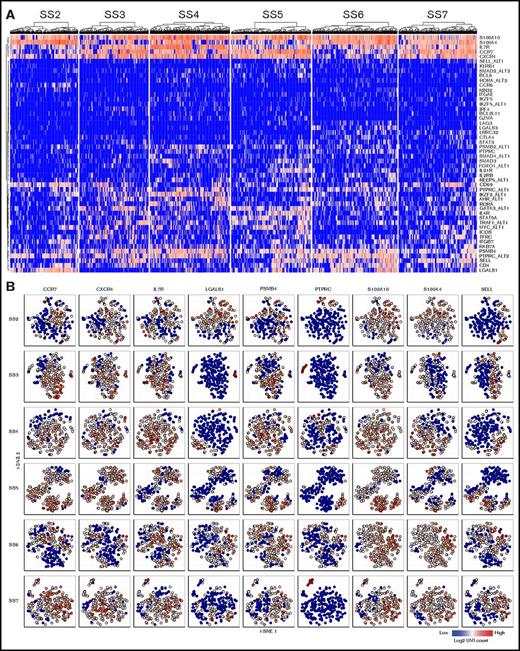 Figure 4. Single-cell mRNA sequencing confirm heterogeneity at the transcriptional level. (A) Heat maps showing the single-cell mRNA expression of malignant cells from 6 patients with SS. (B) Single-cell mRNA coexpression of CCR7, CXCR4, IL7R, LGALS1, PSMB4, PTPRC, S100A10, S100A4, and SELL within the malignant population of 6 patients with SS visualized by t-SNE plots. Color indicate the log2 transformed number of unique molecular identifier (UMI) counts for each gene from the individual cells.