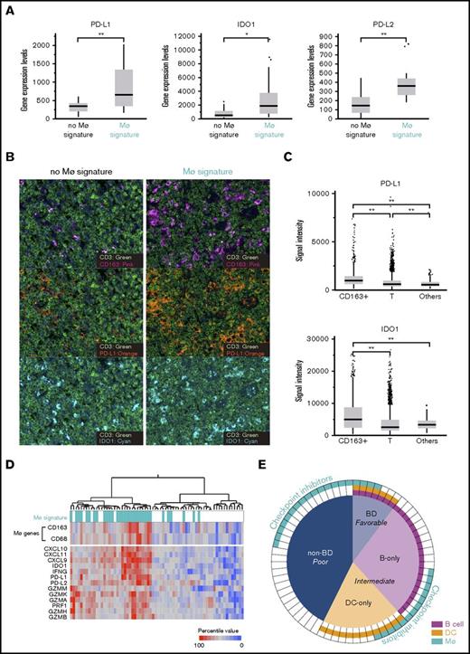 Figure 4. Tumor-infiltrating macrophages express immune-checkpoint molecules. (A) Box-and-whisker plots show PD-L1, IDO1 and PD-L2 mRNA levels, as revealed by nCounter. *P < .05, **P < .01 (Wilcoxon rank-sum test). (B) IF was performed using antibodies against CD3 (green, T cells), CD163 (pink, macrophages), PD-L1 (orange), and IDO1 (cyan). Representative images for cases with (right) or without (left) macrophage signatures are shown. Immunofluorescence; original magnification ×20. (C) Box-and-whisker plots represent average signal intensities of PD-L1 (top) or IDO1 (bottom) per cell among indicated cell types. Data were obtained from 3 independent macrophage signature–rich cases. Dots represent outliers. **P < .01 (Wilcoxon rank-sum test). (D) Heat map for hierarchical clustering of 68 PTCL-NOS cases based on expression levels of genes related to macrophage and tumor-associated inflammation. (E) Summary of 68 PTCL-NOS cases stratified based on microenvironmental immune cell signatures. Predictive prognostic values and proposed therapy are shown.