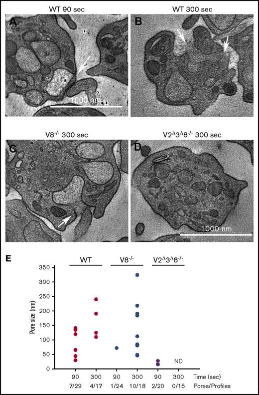 Figure 5. The loss of VAMP8 delays fusion pore formation and dilation. Platelets from the indicated strains were isolated and fixed in resting or thrombin-stimulated states (0.1 U/mL thrombin for 90 or 300 seconds). EM tomographs were analyzed for fusion pore structures, and the diameters were measured in z-series. Representative EM images of WT platelets at 90 seconds (A) and at 300 seconds (B), V8−/− platelets at 300 seconds (C), and V2Δ3Δ8−/− platelets at 90 seconds (D). The arrows indicate fusion pores. (E) The distribution of fusion pore size in platelets at early (90 seconds) and late (300 seconds) times poststimulation for the indicated strains is graphed as a scatter plot. Mean pore sizes are as follows: (WT: 90 seconds, 82.4 nm; WT: 300 seconds, 166 nm; V8−/−: 90 seconds, 72 nm; V8−/−: 300 seconds, 160.8 nm; V2Δ3Δ8−/−: 90 seconds, 21 nm, V2Δ3Δ8−/−: 300 seconds, pores could not be detected). Pores detected per platelet profile are indicated. ND, not detected.