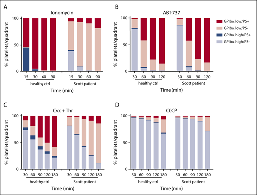Figure 4. Normal glycoprotein shedding in Scott syndrome platelets with defective PS exposure. Platelets from a healthy control subject or a Scott patient were stimulated with 10 µM ionomycin (A), 10 µM ABT-737 (B), 100 ng/mL convulxin and 4 nM thrombin (C), or 100 µM CCCP (D) at 37°C. GPIbα expression and PS exposure were measured at the indicated time points. Platelets were separated into 4 populations (GPIbαhigh PS−, GPIbαhigh PS+, GPIbαlow PS−, and GPIbαlow PS+) and quantified. Data are means of 3 replicates.