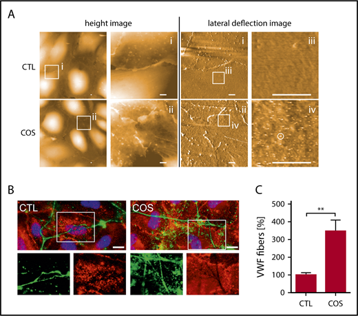 Figure 2. COS-induced modification of the endothelial glycocalyx promotes VWF binding. (A) Surfaces of HUVECs, treated with COSs (2µg/mL) or untreated (CTL), imaged by AFM. Height images provide 3-dimensional topography of the cellular surface. The height is false color coded. Black corresponds to a height of 0 µm and white to a height of 2 µm. Overview images are further magnified as indicated by square regions (i-ii). Corresponding lateral deflection images show the interaction between the scanning tip and the cellular surface in the depicted areas (i-ii). Further magnification of the lateral deflection images indicate an increased lateral deflection (white circle) on HUVECs treated with COSs in comparison with nontreated cells (CTL) (iii-iv). Scale bars, 1 µm. (B) Fluorescence microscopic analysis of the endothelial glycocalyx (red) and anchored VWF fibers (green). Cell nuclei are labeled in blue. The endothelial glycocalyx staining was more pronounced in COS-treated HUVECs. The lack of the endothelial glycocalyx staining beneath VWF fibers, which were in close proximity to the HUVEC surface, indicates an occupation of the HS chains by VWF. Scale bars, 10 µm. (C) Quantitative evaluations of VWF fluorescence staining of at least 10 fields of view of 3 independent experiments. **P ≤ .01 (Student t test).