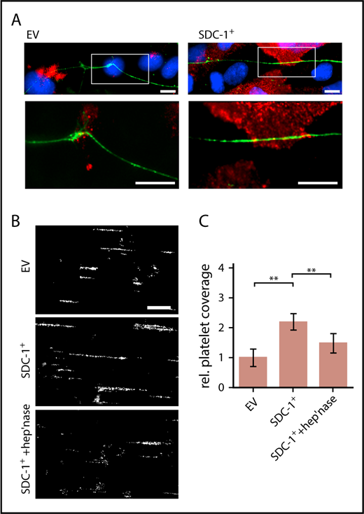 Figure 5. Interaction between endothelial SDC-1 and VWF fibers in vitro. (A) Representative images of empty vector (EV)–transfected HUVECs and cells that overexpress SDC-1 (SDC-1+). Magnified regions (white boxes) are shown below. Scale bars, 10 µm. SDC-1 is shown in red, VWF in green, and nuclei in blue. (B) Endothelial SDC-1 promotes the VWF-mediated binding of platelets. HUVECs transfected with an EV control or with an SDC-1 vector (SDC-1+) were perfused at a constant shear stress of 6 dyne/cm2. VWF release was induced by 50 µM of histamine, and adhering fluorescent platelets were followed by fluorescence microscopy. Where indicated, the endothelial glycocalyx was trimmed by heparinase-I (hep’nase). Scale bar, 100 µm. (C) Quantitative evaluation of the VWF-dependent platelet coverage (n = 11). **P ≤ .01 (1-way analysis and Bonferroni post hoc test).