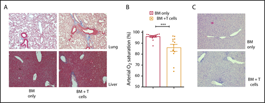 Figure 1. Lung and liver pathology and lung dysfunction in B6→B10.BR mouse model of cGVHD. (A) Collagen deposition (blue staining) in lung and liver of control animals (left column) and cGVHD animals (right column) (Masson’s trichrome staining, Nikon Eclipse Ti microscope, original magnification ×200). (B) Arterial oxygen saturation was measured using pulse oximetry in cGVHD animals; ***P < .001 (Mann-Whitney U test); n = 15 and n = 12 for the BM-only and BM plus T cells groups, respectively. Bars represent standard error of the mean. (C) Lymphocyte infiltration in the liver of control animals (top panel) and cGVHD animals (bottom panel) (hematoxylin and eosin staining, bright-field microscopy using Nikon Eclipse Ti microscope, original magnification ×100).