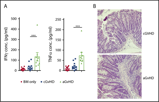 Figure 4. Comparison of cGVHD model and high T-cell dose B6->B10.BR model that mimics aGVHD. B10.BR mice were transplanted with BM only or BM and either a low (5 × 104) or high (5 × 105) dose of T cells from B6 donor mice. Tissues from the animals were harvested on day 17. (A) Levels of TNF-α and IFN-γ in the small intestine of the mice 17 days posttransplant. ***P < .001 (Mann-Whitney U test); n = 12 and n = 9 for cGVHD and aGVHD groups, respectively. Bars represent standard error of the mean. (B) Lymphocyte infiltration in the submucosa of the small intestine of cGVHD (top panel) and aGVHD (bottom panel) animals (hematoxylin and eosin staining, bright-field microscopy using a Nikon Eclipse Ti microscope, original magnification ×100).