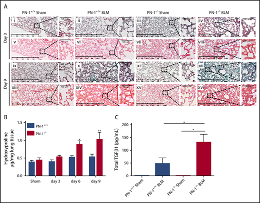 Figure 3. Accentuated pulmonary fibrosis and increased TGFβ1 in PN-1−/− mice. Lungs from PN-1−/− mice and their PN-1+/+ littermates were harvested at the indicated time points after bleomycin-induced lung injury (BLM) instillation for the following analyses. (A) Masson’s trichrome (i-iv, ix-xii) and Sirius red (v-viii, xiii-xvi) staining of lung sections from PN-1+/+ and PN-1−/− mice 3 and 9 days after saline (sham) or BLM treatment. Representative images are shown. Scale bars, 1 mm (main images) and 100 μm (enlargements). (B) Hydroxyproline contents in lung tissues from PN-1−/− and PN-1+/+ mice were measured 3, 6, and 9 days after bleomycin treatment vs saline treatment (sham). Data (mean ± SEM; n = 4-5 per group) were analyzed by 2-tailed Mann-Whitney U test. (C) Total TGFβ levels were measured by enzyme-linked immunosorbent assay in BALFs collected 9 days after saline (sham) or BLM treatment. Data (mean ± SEM; n = 10-13 per group) were analyzed by Kruskall-Wallis test with Dunn’s multiple comparison test. *P < .05, **P < .01 vs sham.