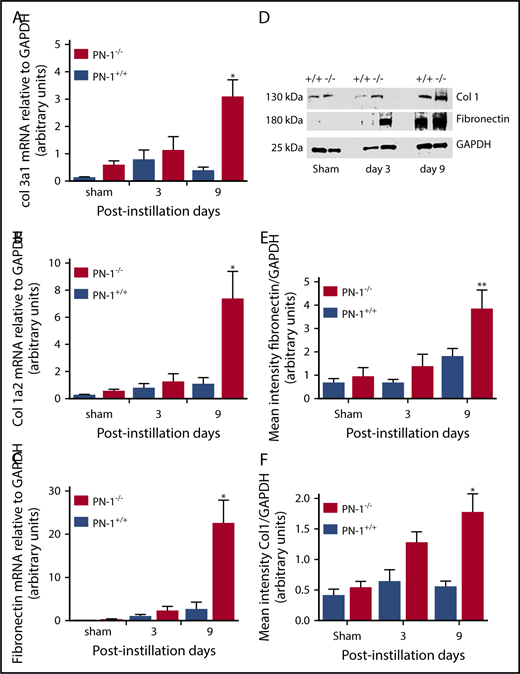 Figure 4. Accentuated overexpression of matrix extracellular proteins in lungs of bleomycin-injured PN-1−/− mice. Lungs from PN-1−/− mice and their PN-1+/+ littermates were harvested at the indicated time points after bleomycin-induced lung injury (BLM) instillation for the following analyses. Quantitative reverse transcription PCR analysis of collagen3α1 (col3α1) (A), col1α2 (B), and fibronectin (C) mRNA expressions in lung tissues. GAPDH was used as an internal control (n = 4 per group). (D) Western blot analysis of type 1 collagen (col 1) and fibronectin. GAPDH was used as a loading control. Densitometric analysis of the corresponding western blot analyses is expressed for fibronectin (E) and col 1 (F) (n = 6-10 per group). For panels A-C and E-F, data represent mean ± SEM and were analyzed by 2-tailed Mann-Whitney U test. *P < .05, **P < .01 vs respective sham.