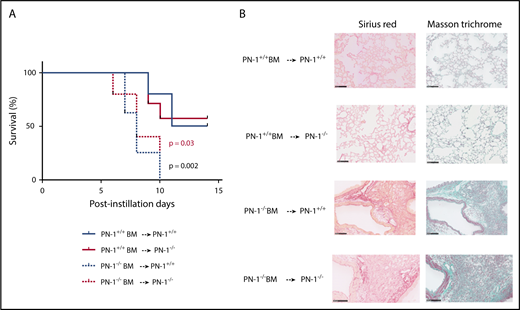 Figure 5. Protective effect of PN-1 from BM cells in bleomycin-injured chimeric mice. PN-1−/− mice and their PN-1+/+ littermates were irradiated and underwent transplantation with BM from appropriated mice and allowed to recover for 5 weeks before bleomycin-induced lung injury. PN-1+/+ BM → PN-1+/+: PN-1+/+ mice receiving PN-1+/+ BM transplants (n = 10). PN-1−/− BM → PN-1+/+: PN-1+/+ mice receiving PN-1−/− BM transplants (n = 8). PN-1+/+ BM → PN-1−/−: PN-1−/− mice receiving PN-1+/+ BM transplants (n = 7). PN-1−/− BM → PN-1−/−: PN-1−/− mice receiving PN-1−/− BM transplants (n = 5). (A) Percentages of surviving mice undergoing transplantation were plotted over a 14-day period after bleomycin treatment. Log-rank test was used to compare the difference between similar recipient mice. P = .03 for PN-1+/+ BM → PN-1−/− vs PN-1−/− BM → PN-1−/−, and P = .002 for PN-1+/+ BM → PN-1+/+ vs PN-1−/− BM → PN-1+/+. (B) Masson’s trichrome and Sirius red stainings of lung withdrawn the day of euthanasia from PN-1+/+ and PN-1−/− chimeric mice. Representative images are shown. Scale bars, 100 µm.