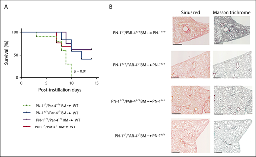 Figure 7. Protective effect of PAR4 expressed on hematopoietic cells in bleomycin-injured lungs. WT mice were irradiated and underwent transplantation with PN-1−/−/Par4+/+ or PN-1+/+/Par4−/− or PN-1+/+/Par4+/+ or PN-1−/−/Par4−/− BM and allowed to recover for 5 weeks before bleomycin-induced lung injury. PN-1−/−/Par4+/+ BM → WT (n = 10). PN-1+/+/Par4−/− BM → WT (n = 12). PN-1+/+/Par4+/+ BM → WT (n = 8). PN-1−/−/Par4−/− BM → WT (n = 12). (A) Percentages of surviving mice undergoing transplantation were plotted over a 14-day period after bleomycin treatment. Log-rank test was used to compare the difference between recipient mice: P = .01 for PN-1−/−/Par4+/+ BM → WT vs PN-1+/+/Par4+/+ BM → WT. (B) Masson’s trichrome and Sirius red stainings of lung withdrawn the day of euthanasia from WT chimeric mice. Representative images are shown. Scale bars, 500 µm.